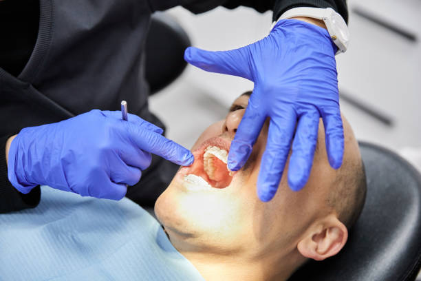 Best Emergency Wisdom Teeth Removal in Beckley, WV
